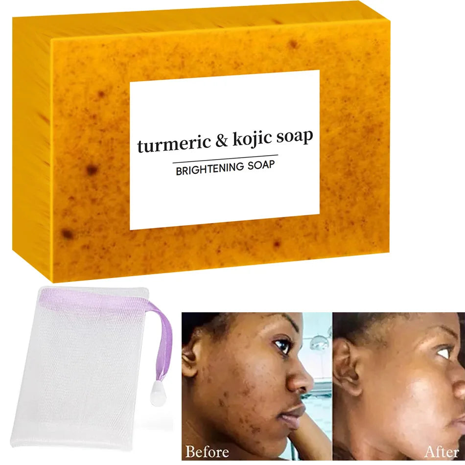 Turmeric Kojic Acid Soap Dark Spot Acne Removal Even Skin Tone Smooth Skin Handmade Soap